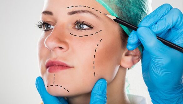 Plastic Surgery